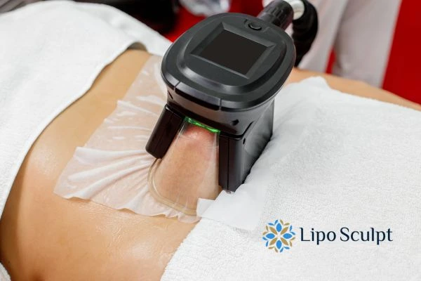 Does Fat Freezing at Home Work? DIY Devices vs Professional Cryolipolysis 1 How is professional cryolipolysis different Bricket Wood?